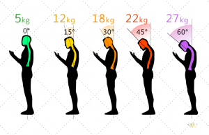 首の痛みやコリの原因はスマホかもしれないです。