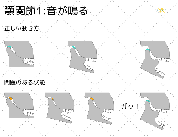 噛むと顎ナ鳴る